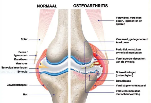 Normal joint